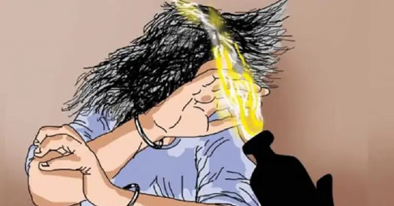 যশোরে একই পরিবারের ৩ জনের ওপর অ্যাসিড নিক্ষেপ